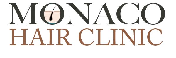 Monaco Hair Clinic en Barcelona - Trasplante Capilar Barcelona
